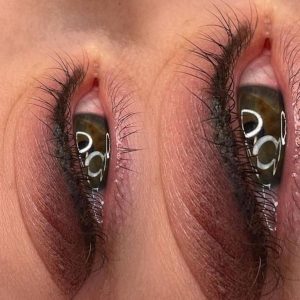 augen